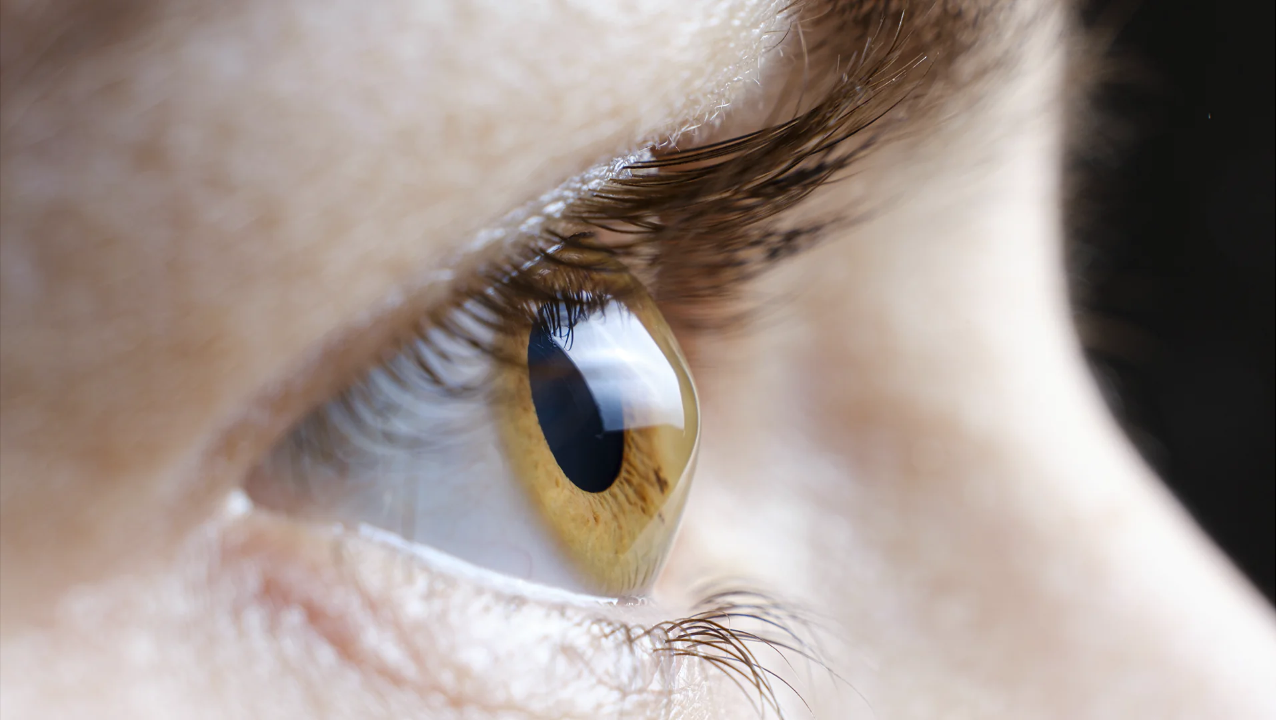 Projeto que institui campanha de conscientização sobre ceratocone é aprovada em 2º turno